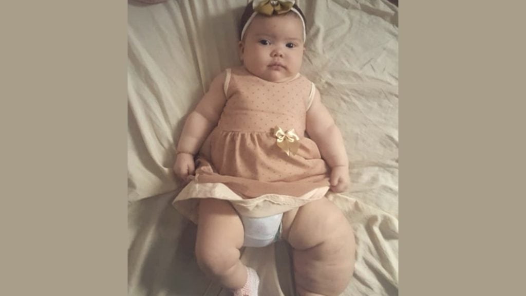 Saiba como ajudar a pequena Gabriella Tenório