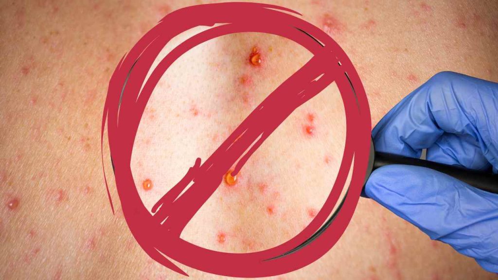 Dia “D” da campanha acontece sábado para jovens de 20 a 29 anos