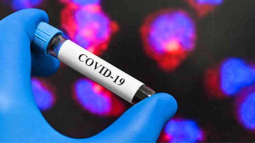 Guardas civis municipais fazem testes para Covid-19