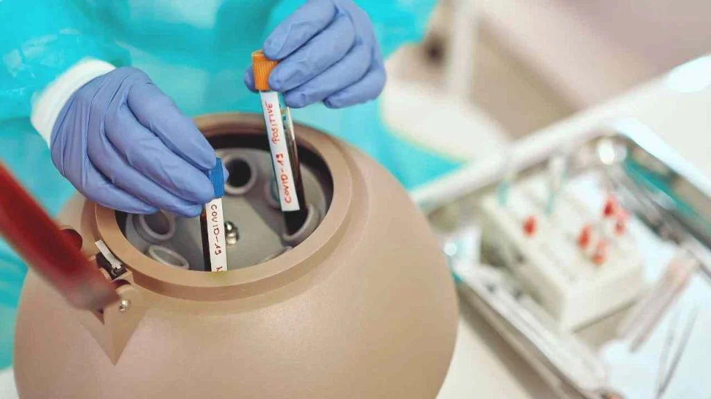 Covid-19: Brasil não tem caso de reinfecção confirmado, diz diretor