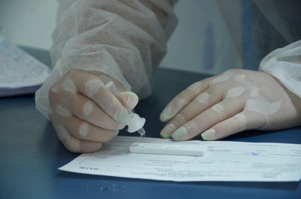 Secretaria de Saúde inicia ações de testagem de covid-19 e outras infecções virais a partir desta quinta