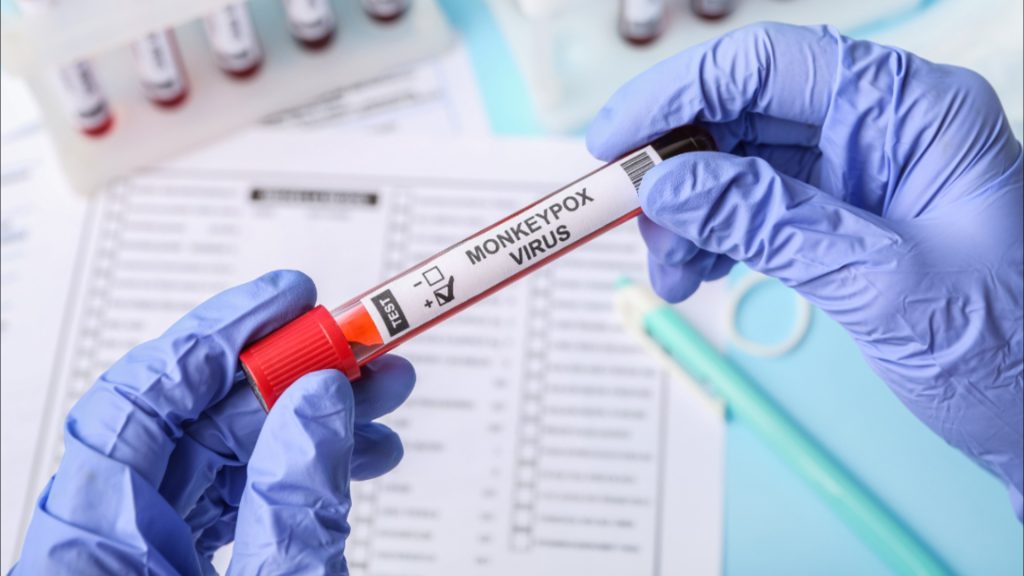 O Lacen-PB vai realizar exames para detecção de varíola dos macacos